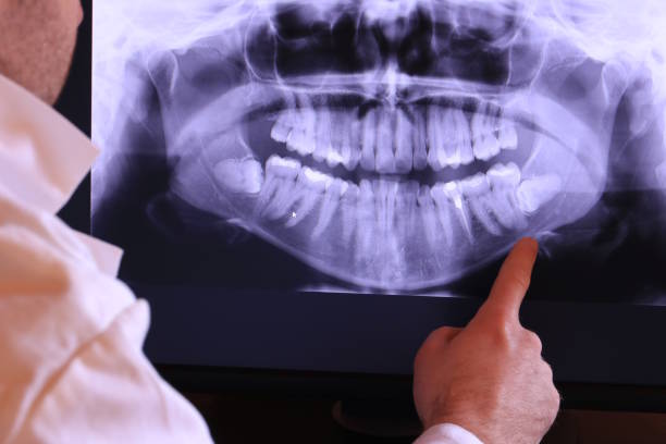 Best Pediatric Emergency Dentist in Warrenvle, IL